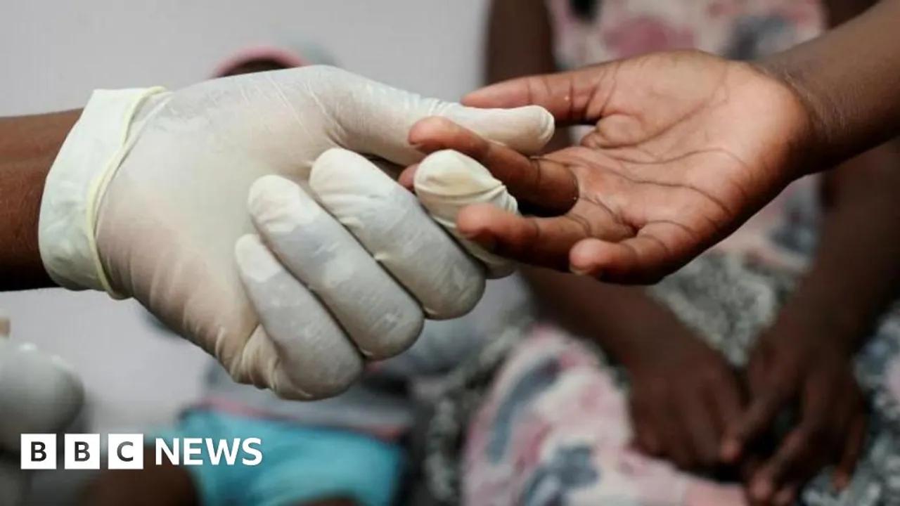 Us Aid Cuts Threaten Treatment For South Africa's Hiv Patients Image