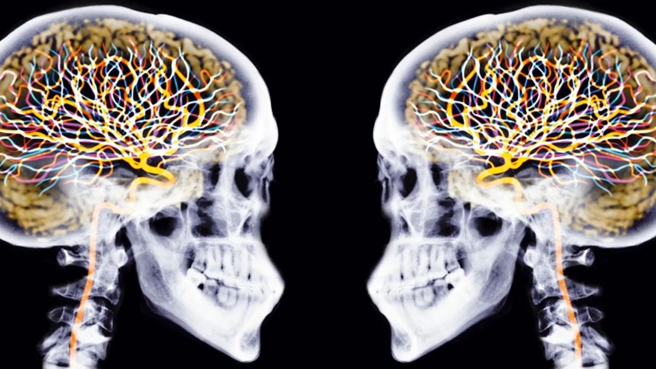 Brain Age As A Predictor Of Lifespan: New Research Insights Image