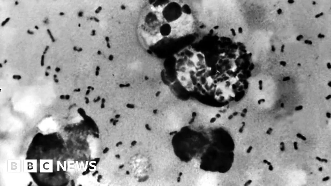 Arizona Reports First Plague Death Since 2007 Image