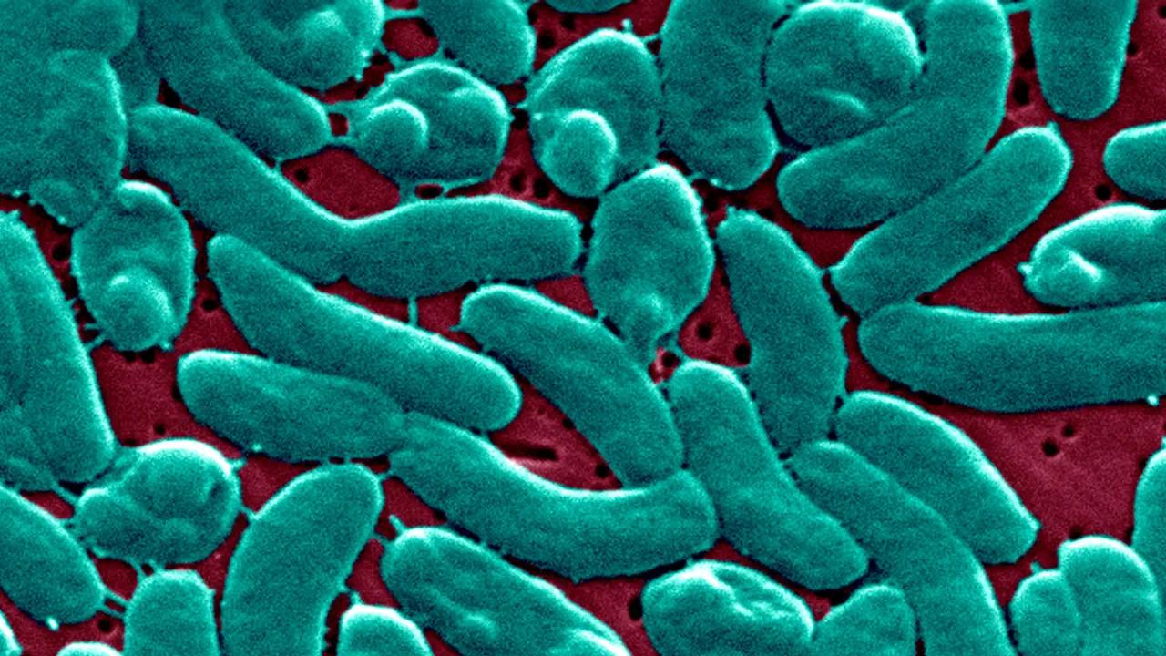 Florida Reports Four Fatal Cases Of Flesh-eating Bacteria Image