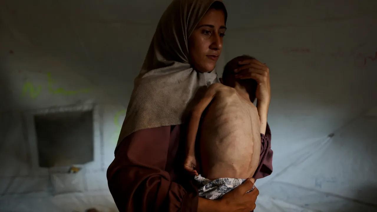 Current Crisis In Gaza: Starvation And Conflict Image