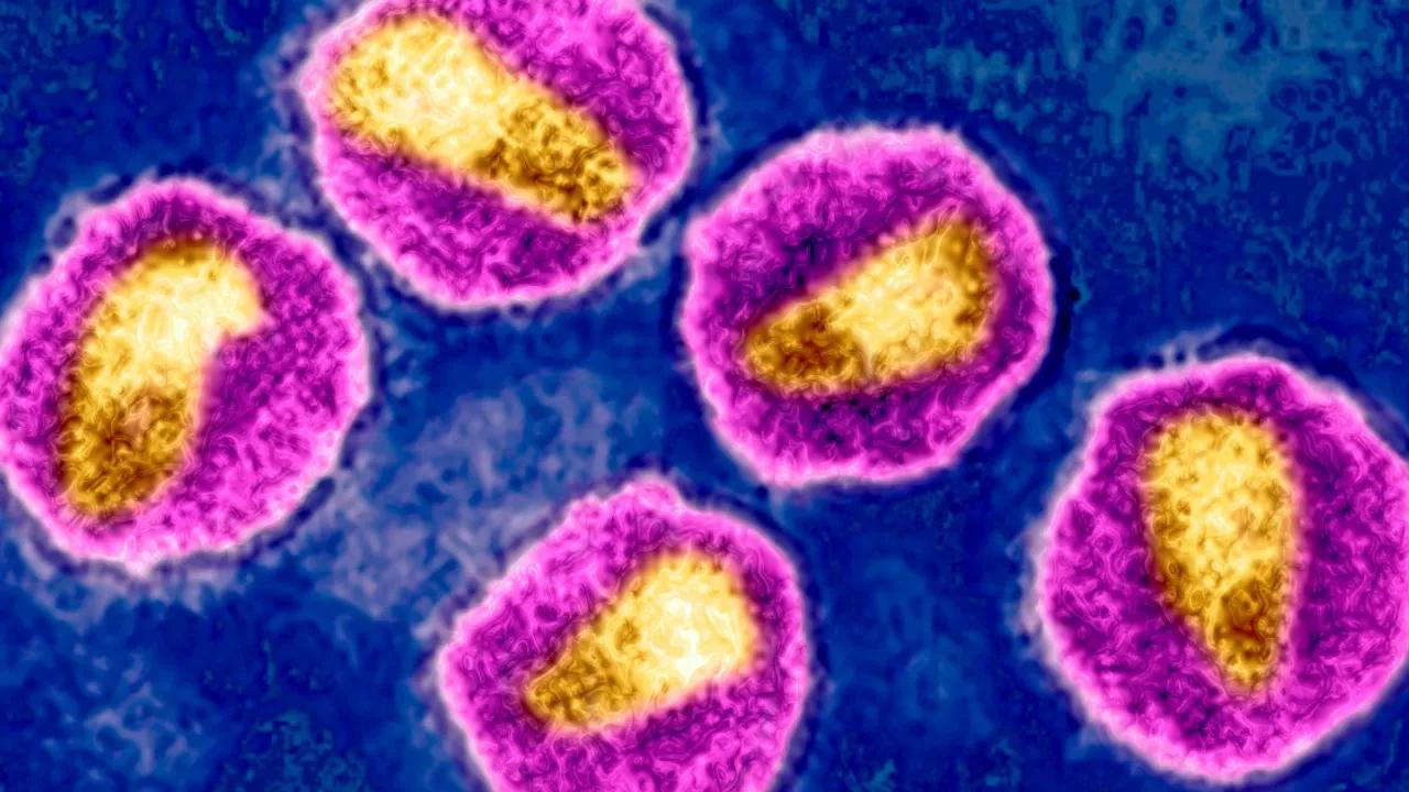 E.u. Approves Injectable Hiv Drug To Help End Transmission Image