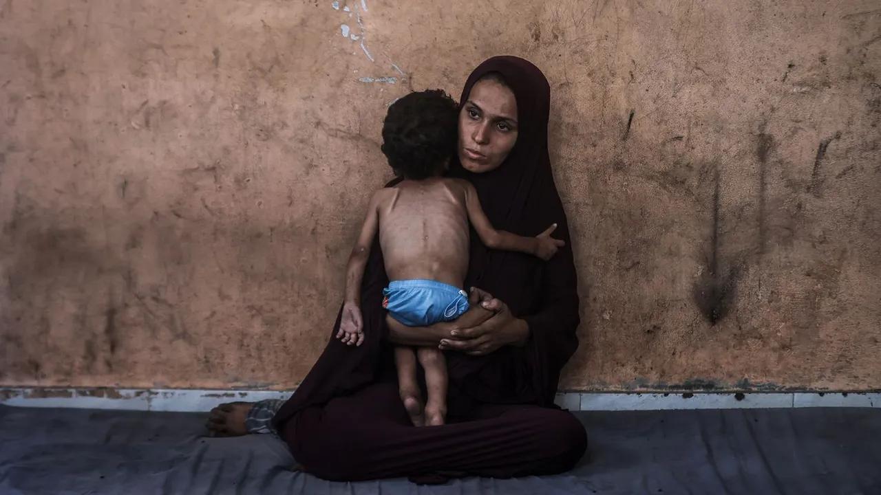 Trump Disagrees With Netanyahu On Gaza Starvation Issue Image