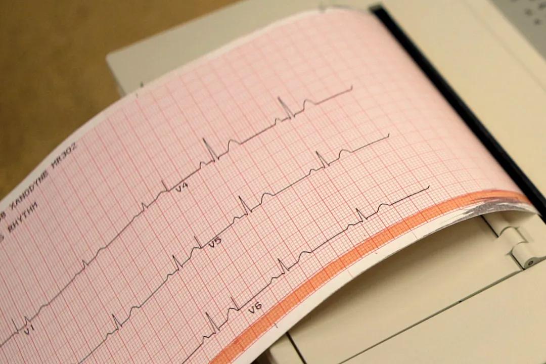 Understanding The Hidden Heart Risk: Lipoprotein(a) Image