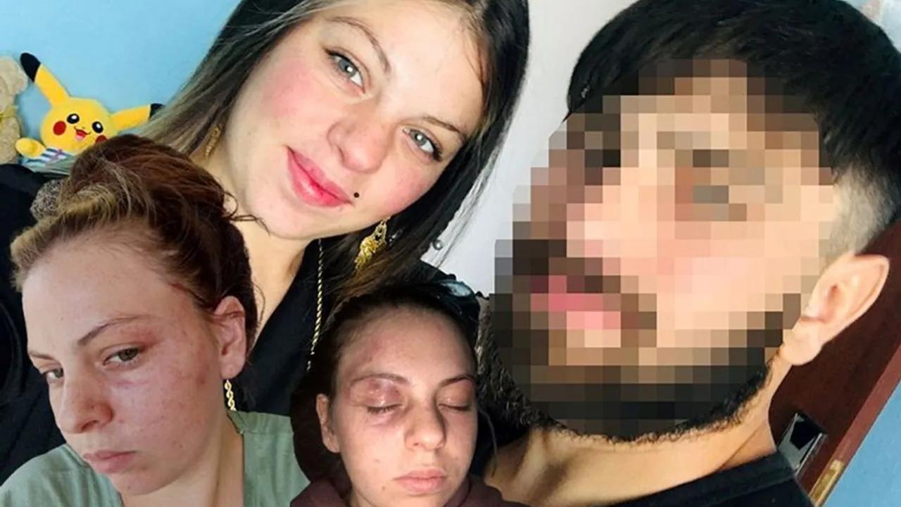 Milli Sporcu Eşi Tarafından Şiddet Gören Kadının Dramı Image