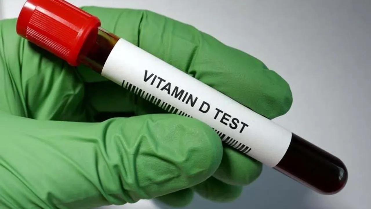 Cilt Kanserine Karşı Korunma Yöntemleri ve D Vitamini Alımı Image