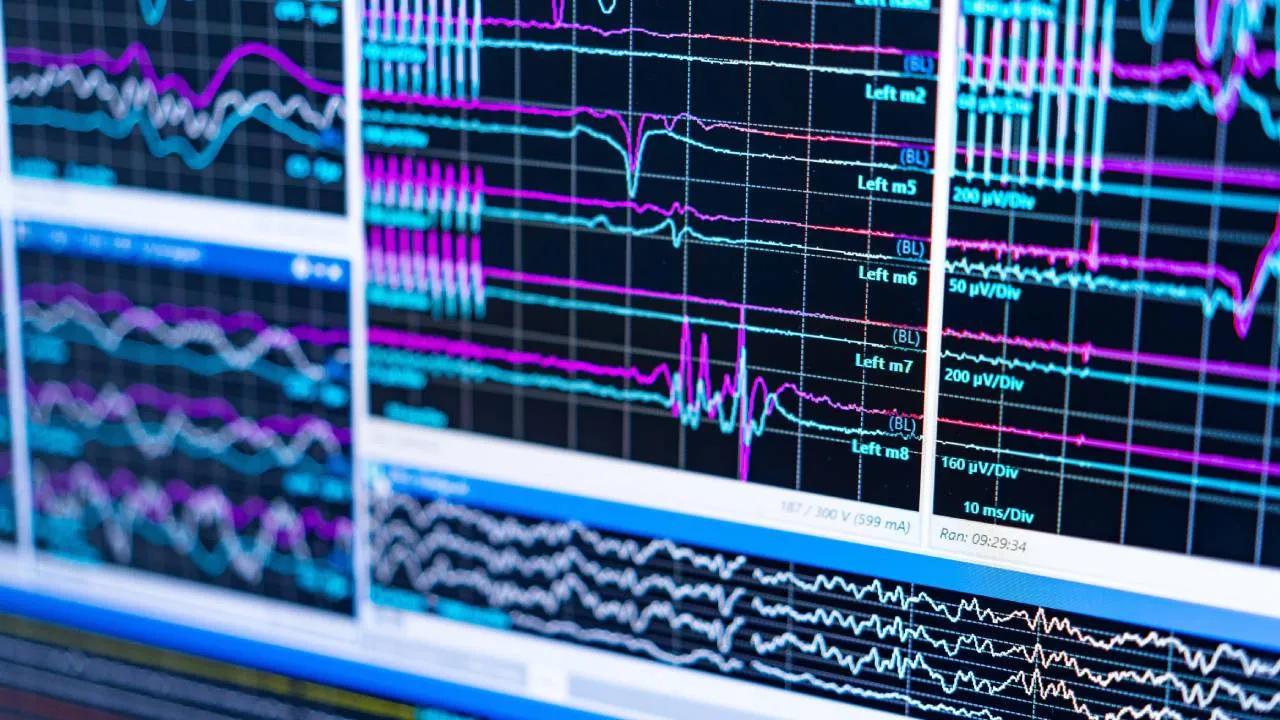 Harvard Araştırması: Lityumla Alzheimer'ın Geriye Döndürülmesi Mümkün Image