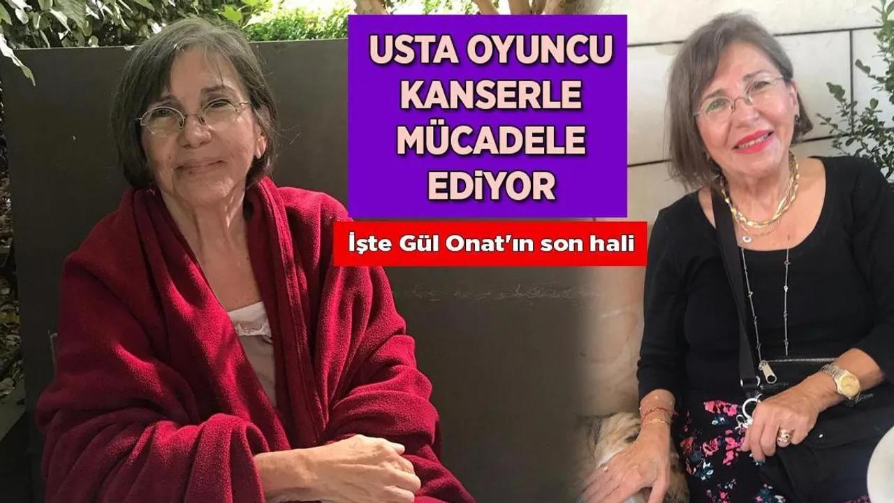 Gül Onat'ın Kanserle Mücadelesi ve Son Durumu Image