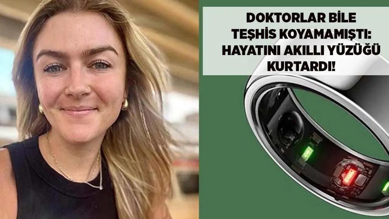 Akıllı Yüzük, Genç Kadının Hayatını Nasıl Kurtardı? Image