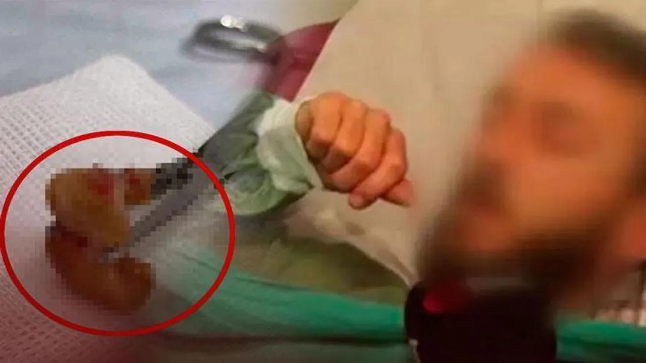 İstanbul'da Şaşırtan Olay: Dişler Ciğerden Çıktı Image