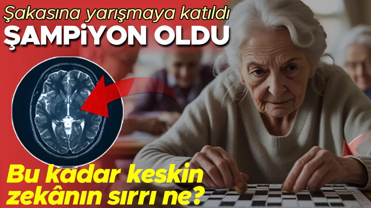 Süper Yaşlıların Keskin Zekasının Sırrı Nedir? Image